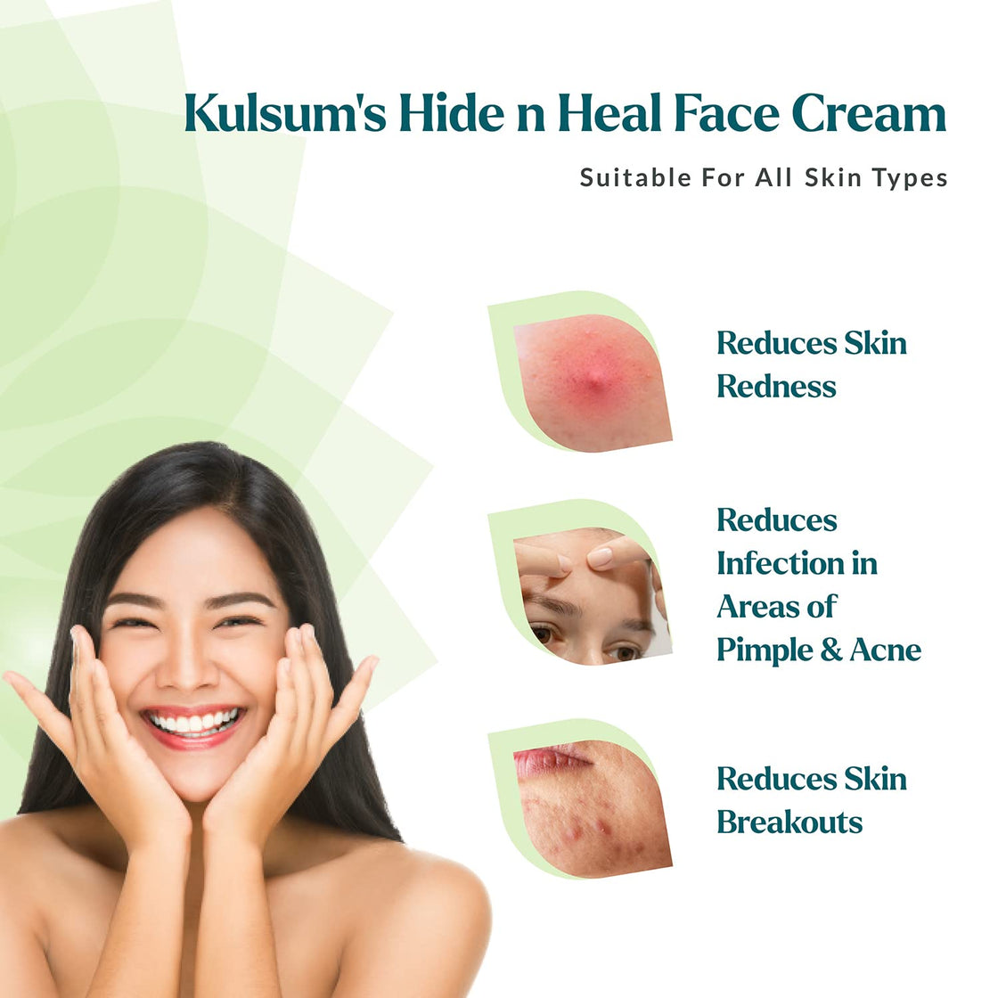 Kulsum's kayakalp Hide N Heal Face Cream (200gm)