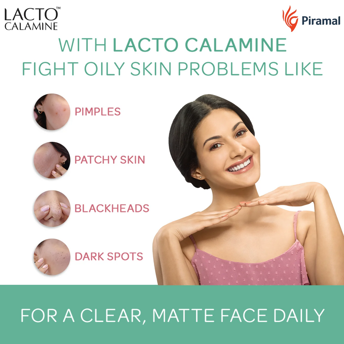 Lacto Calamine Daily Face Lotion  Face Moisturize ( 60ml )