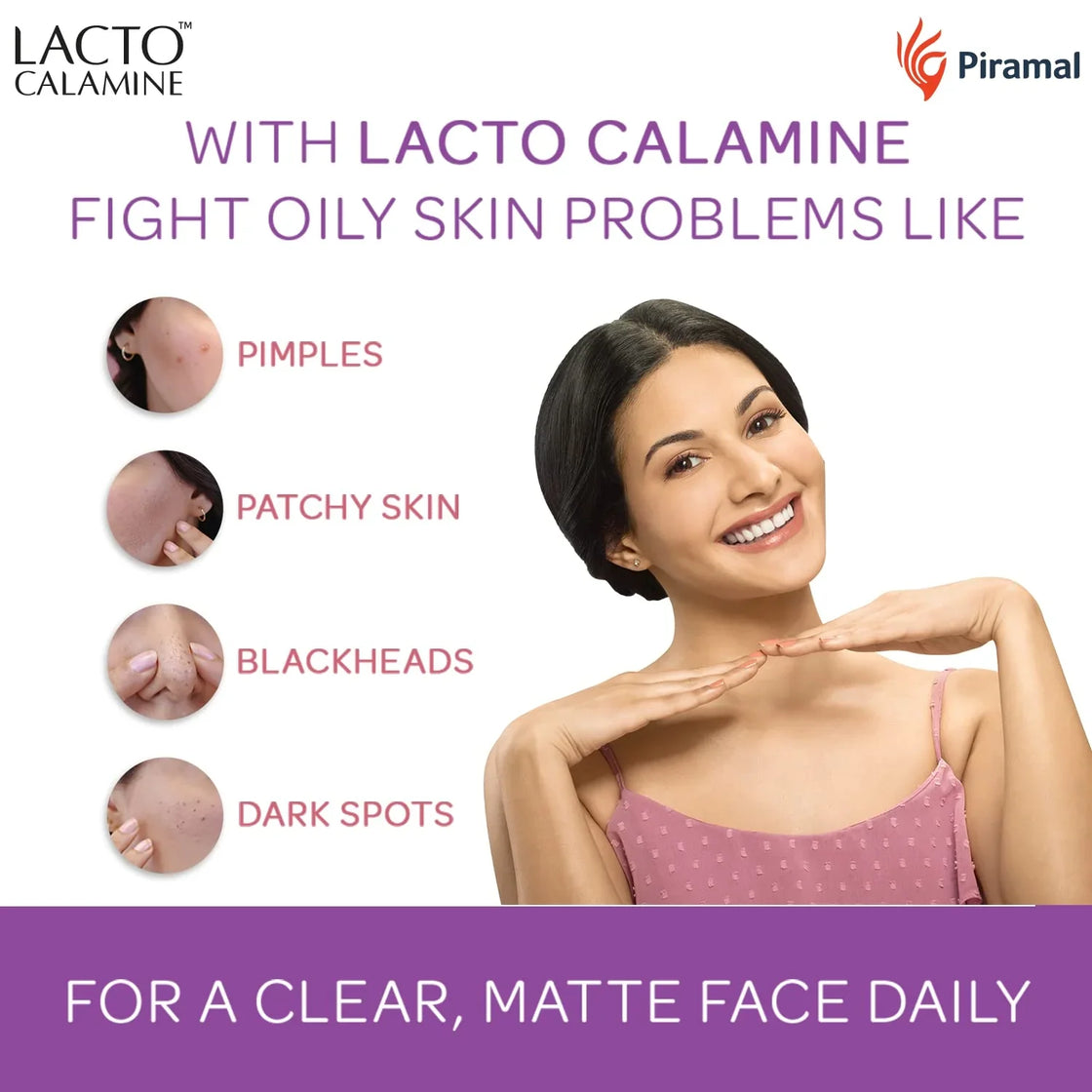 Lacto Calamine Daily Face Lotion  Face Moisturizer For Oily Skin ( 60ml )