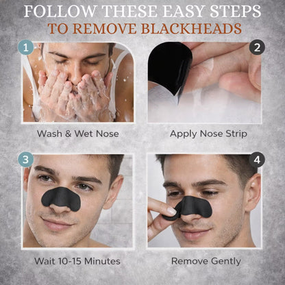 Allure Activated Charcoal Nose Strips For Blackhead Removal (8pcs)